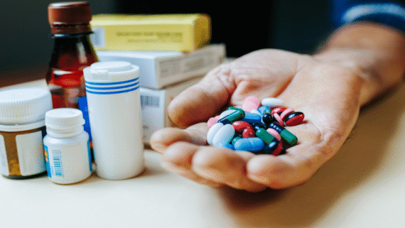 manage anxiety without medication